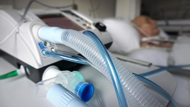 Produsen di Inggris merancang ventilator baru bernama CoVent yang khusus buat menangani pasien Covid-19.