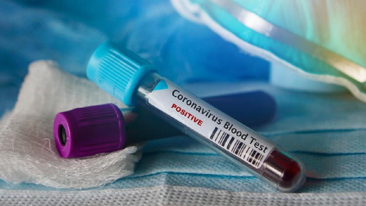 Jangan sampai anak kita terpapar virus yang menakutkan ini ya, Bun. Agar tahu tips dan kiatnya, ikuti perbincangan dengan pakarnya berikut.