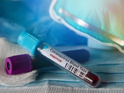 Canggih! UGM Bikin Alat Tes COVID-19, Bisa Deteksi Corona Dalam 80 Detik