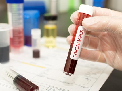 Update Corona di Indonesia: 228.993 Positif, 164.101 Sembuh & 9.100 Meninggal