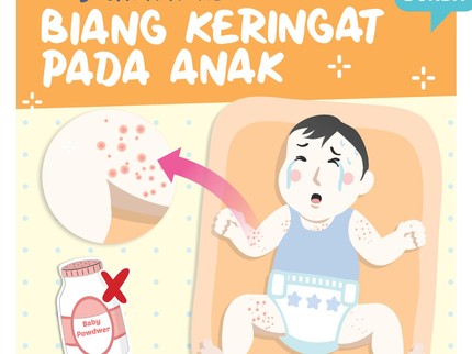 5 Cara Atasi Biang Keringat pada Anak