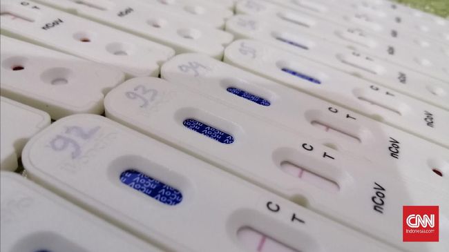 Cara membaca hasil rapid test antigen