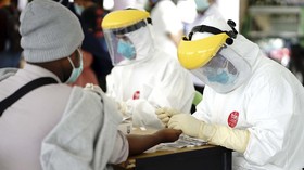 Gejala Penyakit Kawasaki yang Dikaitkan dengan Covid-19