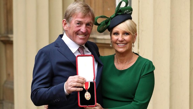 Legenda Liverpool Kenny Dalglish positif virus corona meski tak menunjukkan gejala pada umumnya.