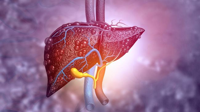 Ameer Azzikra meninggal dunia pada Senin (29/11). Ameer diketahui menderita infeksi liver. Berikut penjelasan mengenai infeksi liver.