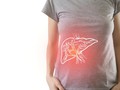 Gejala Sirosis, Kondisi Kronis dari Penyakit Liver