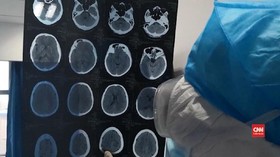 VIDEO: Ahli Ungkap Tiga Varian Mutasi Virus Corona Covid-19