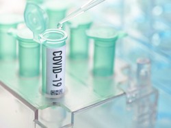 2 Orang Meninggal karena Virus Corona, Malawi Umumkan Lockdown