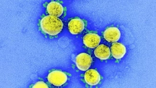 Penelitian di Prancis mendeteksi virus corona varian IHU. Varian IHU disebut menyebabkan gejala Covid-19 yang ringan.