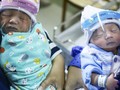 Satgas: Ibu Positif Covid-19 Boleh Kontak dengan Bayi