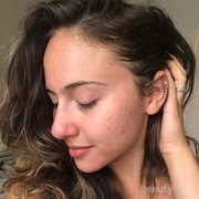 Ini 4 Tips Memilih Make Up Bagi Pemilik Kulit yang Rentan Berjerawat