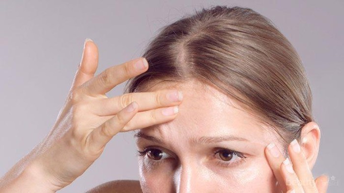 Jerawat Muncul di Kepala? Jangan Khawatir, Coba Atasi dengan 4 Bahan Alami Ini