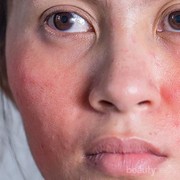 Jangan Coba-coba, Pemutih Racikan Abal-Abal Ini Berbahaya!