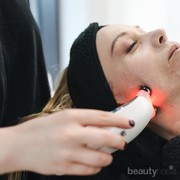 3 Mitos yang Perlu Kamu Ketahui Sebelum Melakukan Laser Wajah