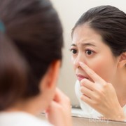 Selamat Tinggal Komedo, Yuk Basmi dengan 4 Bahan Dapur Ini!