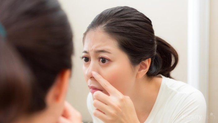 Selamat Tinggal Komedo, Yuk Basmi dengan 4 Bahan Dapur Ini!