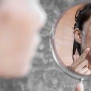 Sun Spot Atau Dark Spot? Kenali Perbedaannya, Yuk!