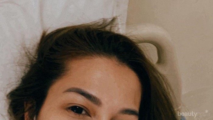 Seteleh Positif, Andrea Dian Kini Negatif Virus Corona