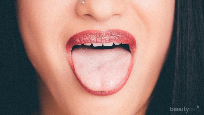 Sariawan di Lidah Menyiksa, Begini Cara Mengatasinya