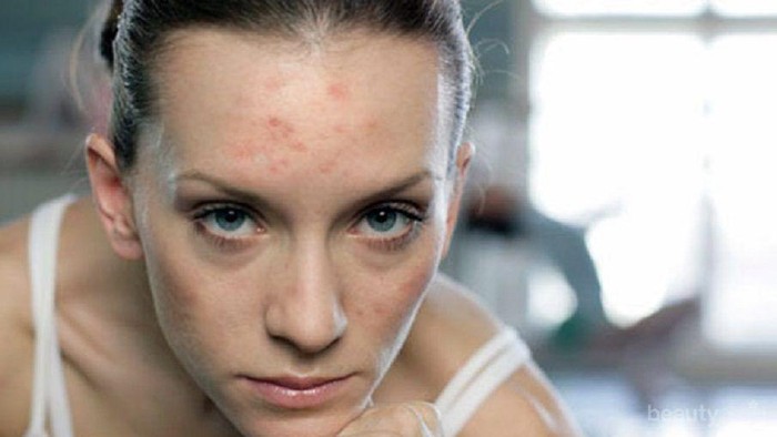 Waduh, 5 Makanan Ini Ternyata Dapat Sebabkan Kulit Kusam dan Kering