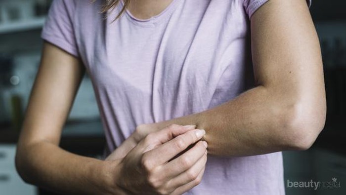 Hilangkan Gatal Menggunakan Obat Tradisional dengan Bahan Alami