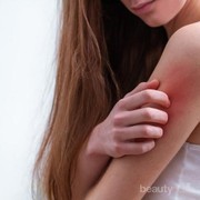 Inilah Cara Merawat Kulit Rusak Pasca Esksim, Simak Yuk!