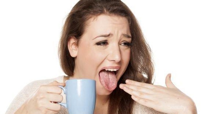 Biar Nyaman Saat Makan, Ini Tips Hilangkan Rasa Pedas Super Cepat