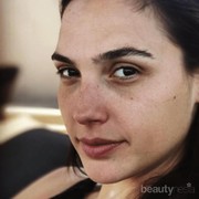 Enggak Pede Karena Flek Hitam? 5 Bahan Alami Ini Bisa Menjadi Solusimu