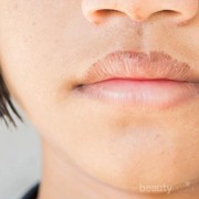 Hati-hati Bibir Pecah-pecah Bisa Jadi Tanda Diabetes, Kok Bisa?