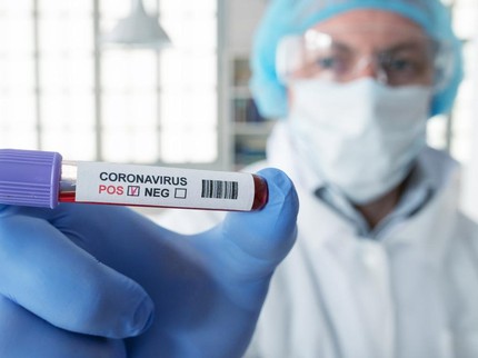 Update Corona di Indonesia: 232.628 Positif, 166.686 Sembuh & 9.222 Meninggal