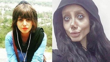 Selebgram Dijuluki 'Zombie Angelina Jolie' Terinfeksi Corona di Penjara