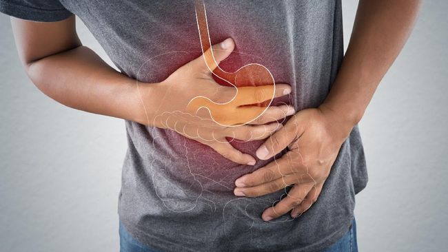 8 Gejala Asam Lambung Naik Heartburn Hingga Batuk Kering