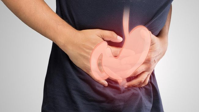 7 Gejala Tak Umum Asam Lambung dan GERD, Bukan Hanya Mual Waspada tujuh gejala asam lambung berikut sehingga Anda tak sampai tumbang oleh penyakit yang diderita banyak orang tersebut.