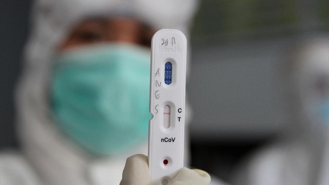 Selama ini kita mengenal metode untuk menentukan warga terinfeksi virus corona melalui rapid test dan PCR, namun baru-baru ini WHO menyarankan agar tidak mendeteksi COVID-19 menggunakan rapid test.