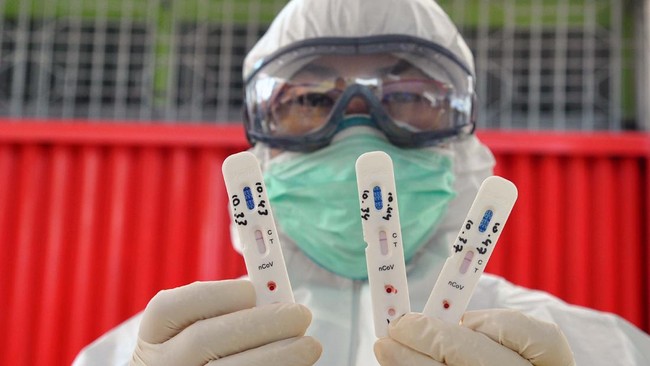 Petugas medis menunjukkan sampel saat Rapid Test di Pasar Bogor, jalan Roda, Suryakencana, Kota Bogor, Jawa Barat, Rabu (29/4/2020). PD Pasar Pakuan Jaya bersama Dinkes Kota Bogor melakukan Rapid Test sebanyak 300 sampel untuk pegawai dan pedagang pasar sebagai upaya antisipasi penyebaran virus Corona (COVID-19) di pasar tradisional Kota Bogor. ANTARA FOTO/Arif Firmansyah/aww.