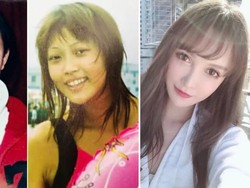 Kisah Wanita China Sudah 100 Kali Operasi Plastik, Masih Belum Ingin Berhenti