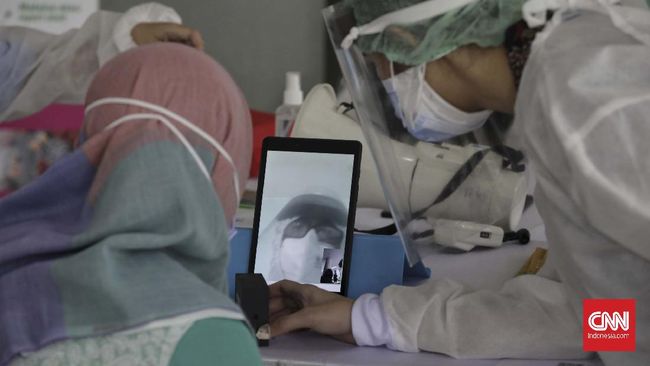 Dokter ahli menyatakan bahwa gangguan fisik pasca infeksi Covid-19 atau long Covid-19 bisa berlangsung berbulan-bulan.