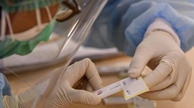 Ahli Epidemiologi Respons Reagen PCR Covid-19 Buatan RI