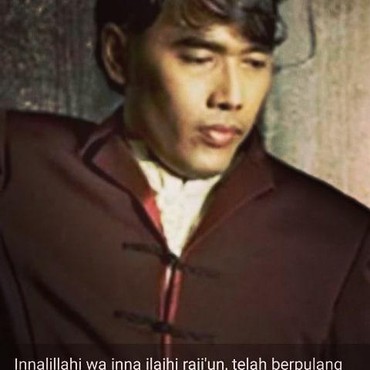 Eks Bassist DEWA 19, Erwin Prasetya Meninggal akibat Pendarahan Lambung