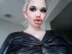 Wanita dengan Bibir Terbesar di Dunia Kecanduan Filler, Ini Penampilannya Dulu