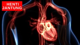 VIDEO : Penjelasan Dokter Soal Henti Jantung