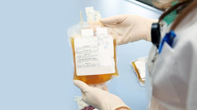 BPOM AS (FDA) menyetujui penggunaan plasma darah untuk pasien Covid-19, dan membantah mendapat tekanan dari Presiden Donald Trump.