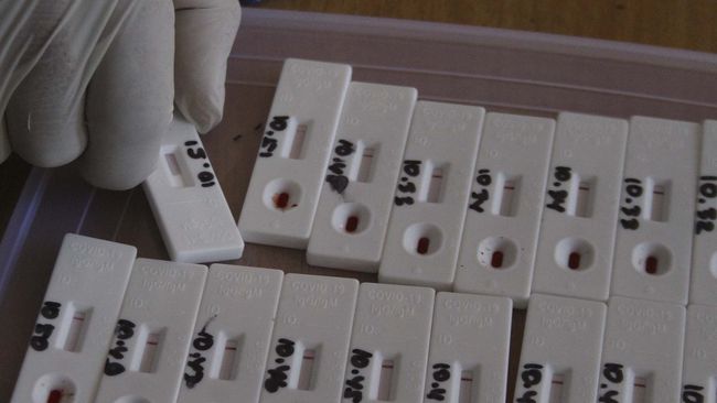 Hasil Rapid Test Indogrosir 2 Pengunjung Terindikasi Positif
