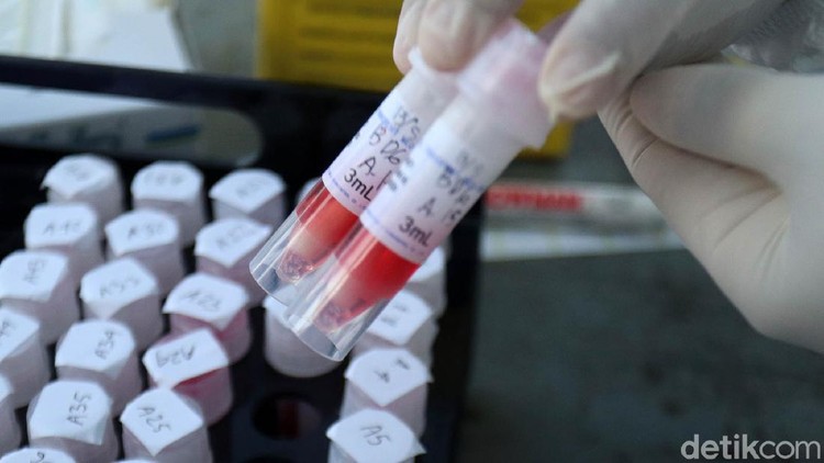 Tes swab terus digalakkan untuk mendeteksi virus Corona (COVID-19). Begini tahapan tes swab COVID-19 di Terminal Cicaheum, Kota Bandung, Rabu (13/5).