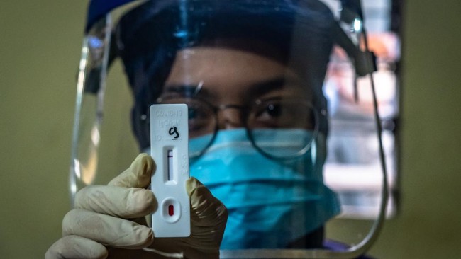 Petugas menunjukkan hasil negatif pada alat pemeriksaan cepat (rapid test) COVID-19 usai memeriksa salah satu pedagang di kawasan Relokasi Pasar Johar, Semarang, Jawa Tengah, Kamis (14/5/2020). Pemeriksaan cepat terhadap sejumlah pedagang di pasar itu guna mengetahui kondisi kesehatan mereka sebagai upaya untuk mencegah penyebaran virus Corona (COVID-19) di tempat keramaian. ANTARA FOTO/Aji Styawan/nz