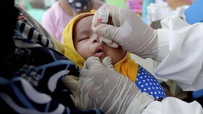 Polio Sampai Lumpuh Ditemukan di Aceh, Kemenkes Gelar Imunisasi Massal