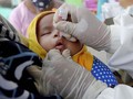 Pandemi Covid-19, 80 Juta Bayi di Dunia Terancam Campak