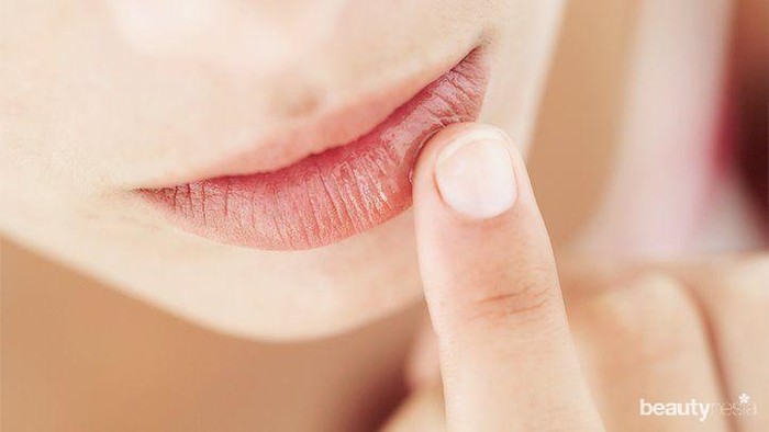 Hindari Bibir Pecah-Pecah Saat Puasa, Ini Cara Gampangnya!
