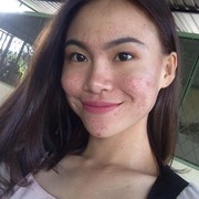 Sering Muncul Jerawat? Ini 5 Rekomendasi Facial Wash untuk Remaja