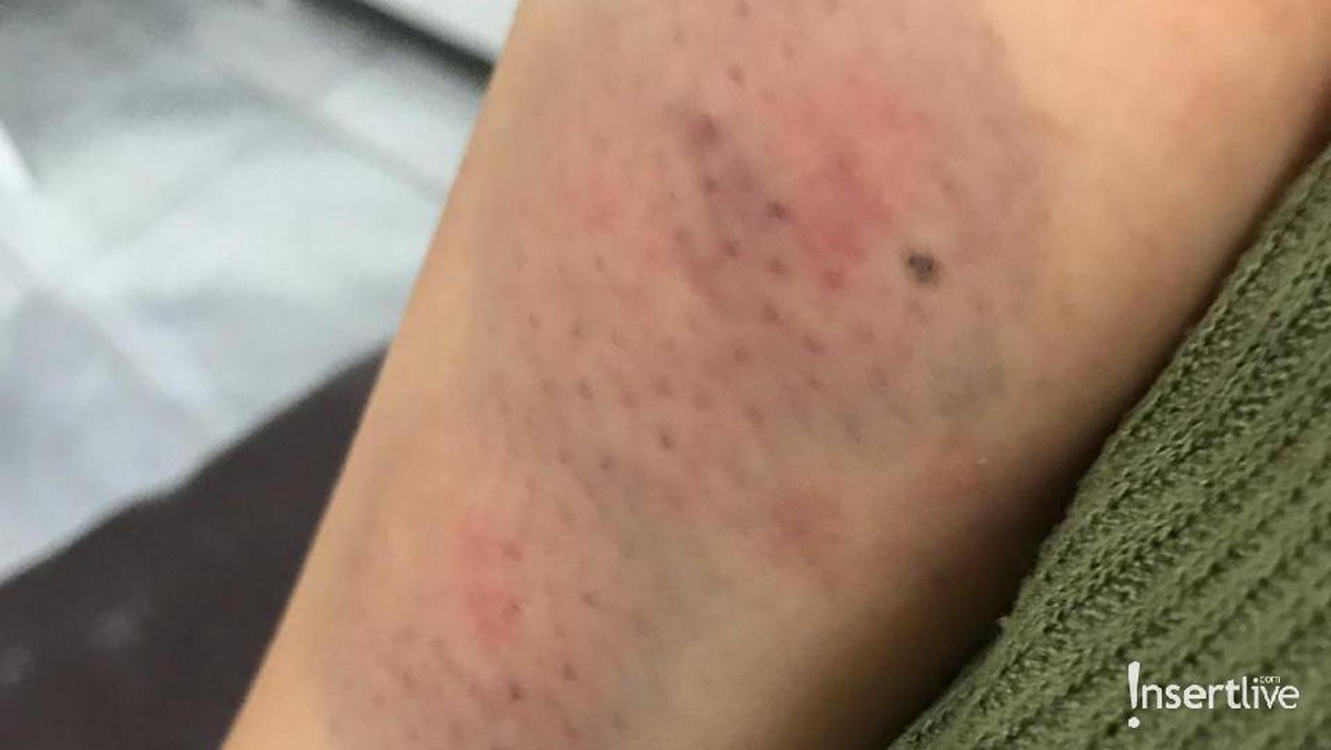 Foto Bukti KDRT Aska Ongi